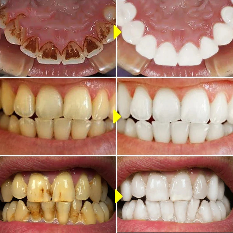 Dentifrice V34pour le blanchiment des dents dans la catégorie des soins buccaux et rafraichissant l'haleine