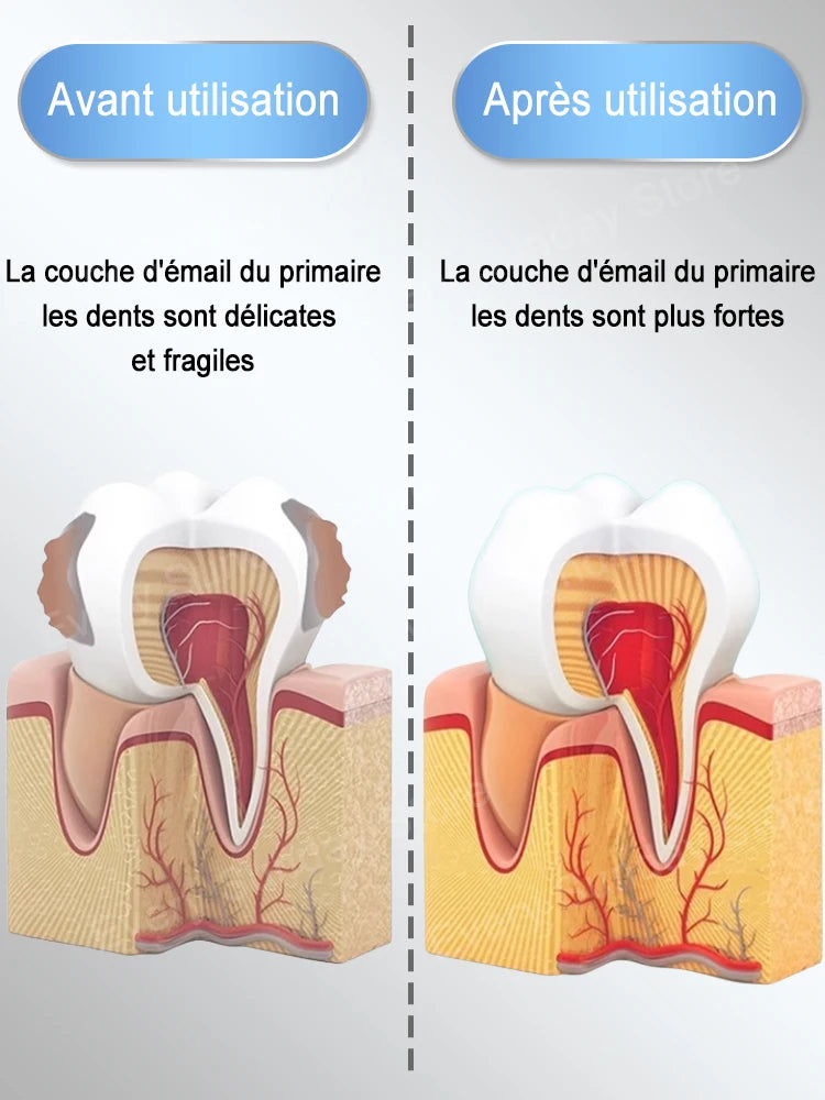 Dentifrice anti carie dentaire